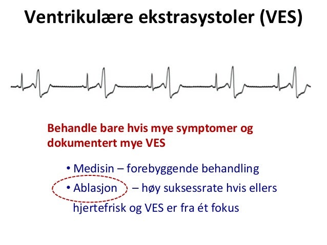 ekstra hjerteslag ekstra hjerteslag